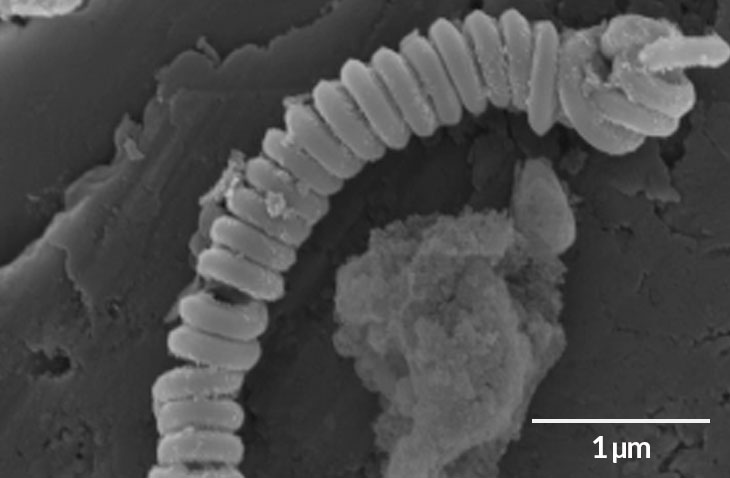 carbon nanotubes