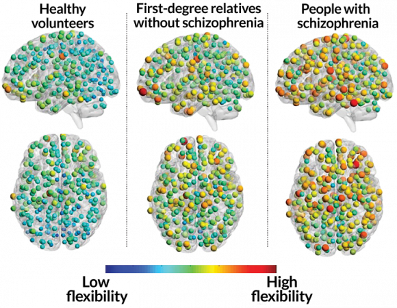 091617_learning-brain_schizo.png