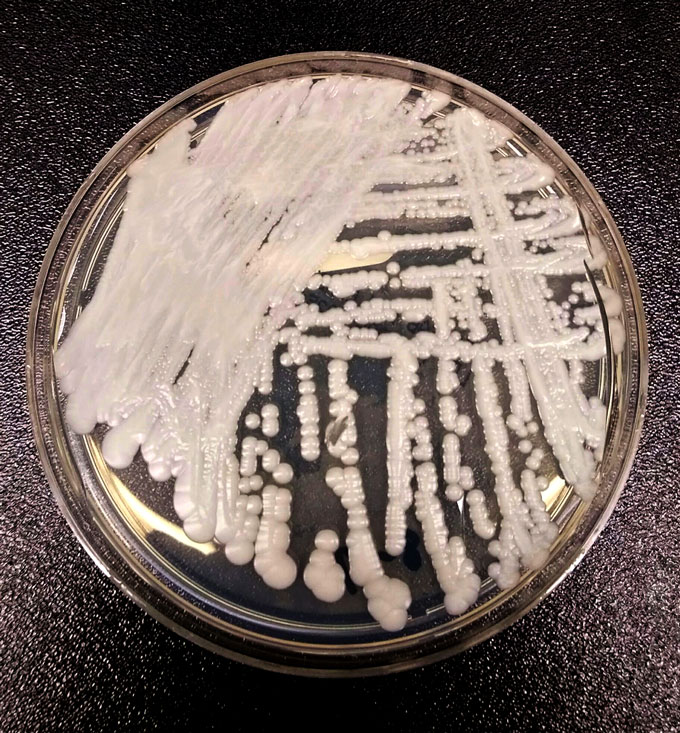 Candida auris