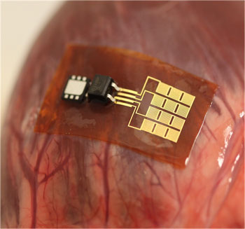 heart device