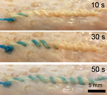 350-suture-soak.jpg