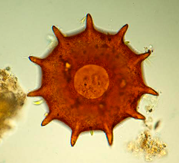 350+Siemensma_Arcella_dentata_amoeba.png