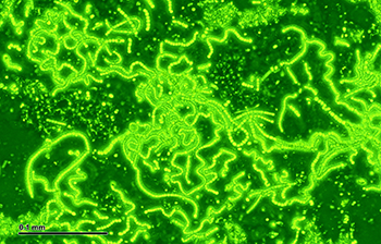 350_Cyanobacteria_bionic_mushroom.png