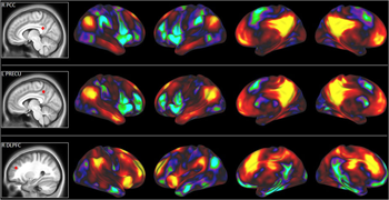 a composite image showing brain activity during a creative thinking task