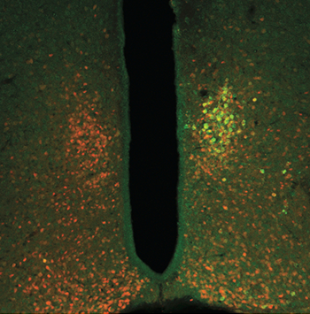 350_inline_ferritin_channel.png