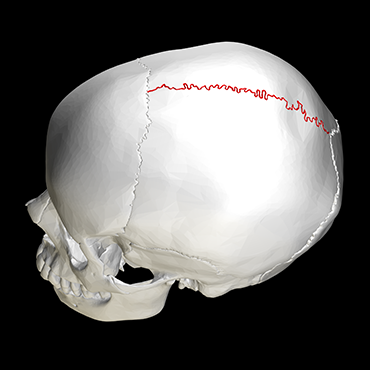 370_ISEF19_Sagittal_suture_skull_-_lateral_view.png