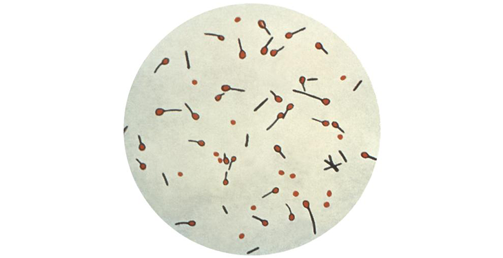 a microscopic image of the Clostridium tetani bacteria
