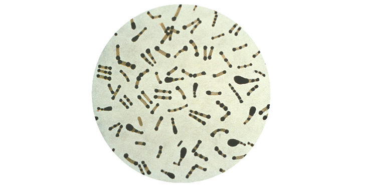 a microscopic image of Corynebacterium diphtheriae bacterium