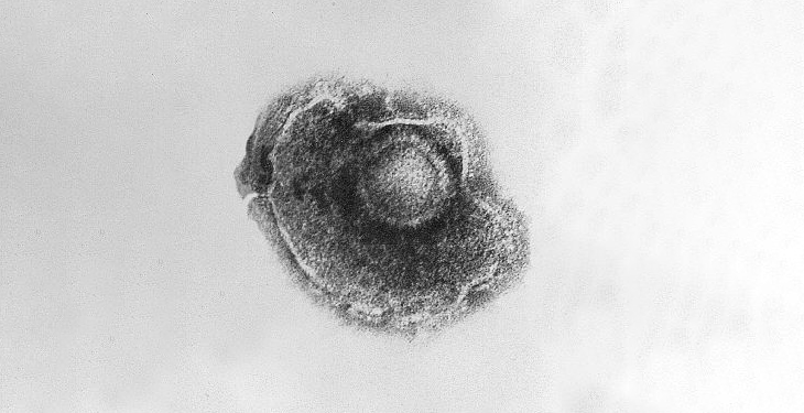 transmission electron microscopic (TEM) image of the Varicella zoster virus