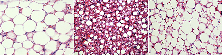 730_white_brown_beige_fat_cells.png