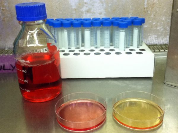 Petri dishes containing induced stem cells in Anne Cherry’s laboratory at Harvard University. Each day, Cherry siphons off the orange, waste-filled liquid and replaces it with a special liquid, called medium. The medium, which appears here in pink, contains nutrients that keep the cells alive. Credit: Courtesy of Anne Cherry