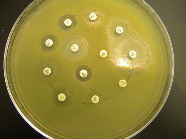 This petri dish shows the effect of antibiotics on coliform bacteria (greenish coloration in the dish) collected from New York’s Genesee River. The white dots are antibiotics added by researchers. The antibiotic labeled GM 10 has wiped out nearby bacteria. But dots such as AM 10 show where bacteria resistant to the antibiotic have grown right up to it. Credit: Courtesy of Jeff Lodge