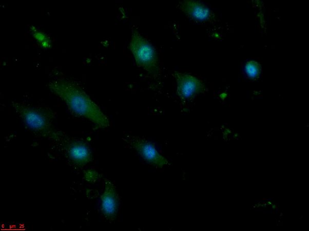 This image shows the abnormal blood vessel cells associated with a rare disease called pulmonary hypertension. The bright spots highlight a protein that Jack Takahashi, 17, showed is present at unusually high levels in the cells. Credit:  Jack Takahashi