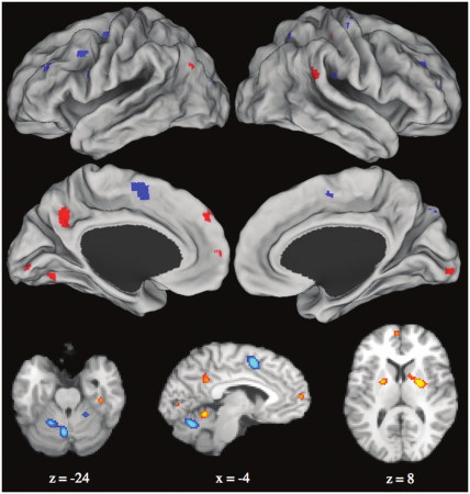 Learning rewires the brain