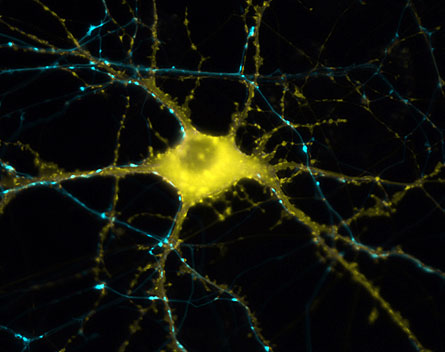 This image shows a neuron as it responds to an electrical signal. The blue traces the path of the signal as it moves through synapses to the neuron.