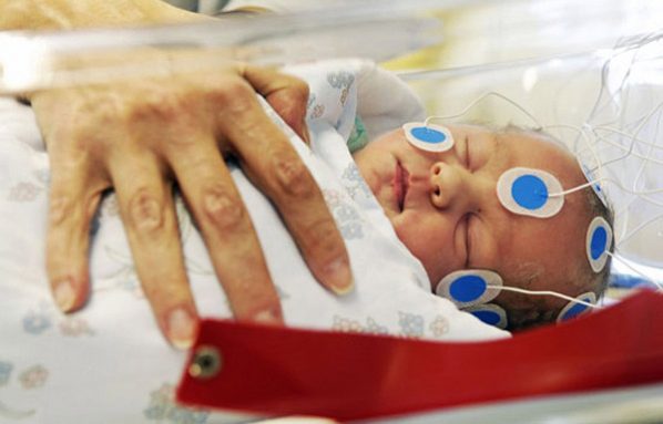 Scientists report that babies learn words before they’re born. The electrodes on this newborn’s head can measure brain activity. Credit: Courtesy of Veikko Somerpuro/Univ. of Helsinki