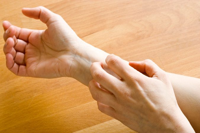 Itchy skin sends a signal to your brain. Scientists have now identified a key player in that process.  Credit: iStockphoto