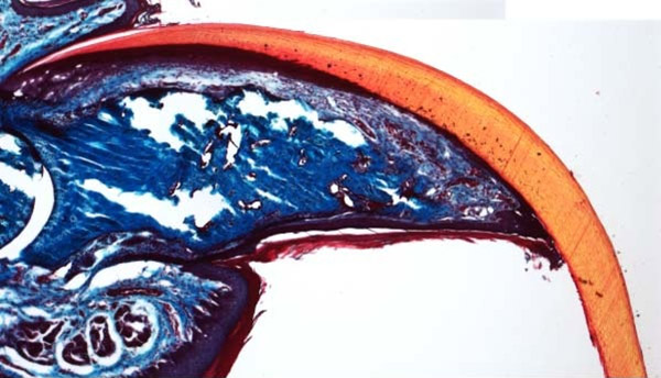 This photo shows the tip of a mouse toe, good as new five weeks after amputation.  Researchers have pinpointed that stem cells at the base of the nail are responsible for the regrowth. Credit: Ito Lab