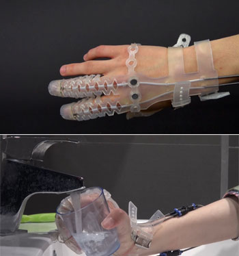 prosthetic fingers glove