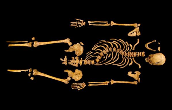 This skeleton found beneath a parking lot in England belonged to Richard III, who ruled England in the 15th century. The bones show his curved spine and reveal the injuries that killed him. Credit: Univ. of Leicester