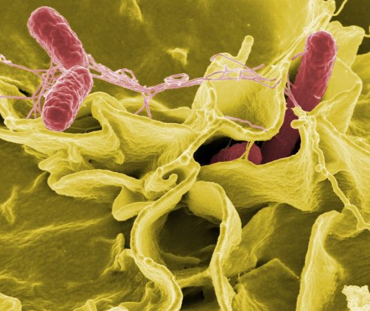Salmonella bacteria (pink) invade a defense cell in the body. The severity of the infection may depend on the time of day the germs are introduced to the body, new research suggests. Credit: National Institute of Allergy and Infectious Diseases (NIAID)