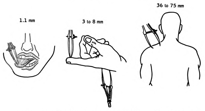 caliper test