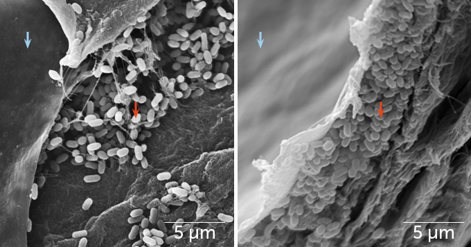 microscope image of melanosomes