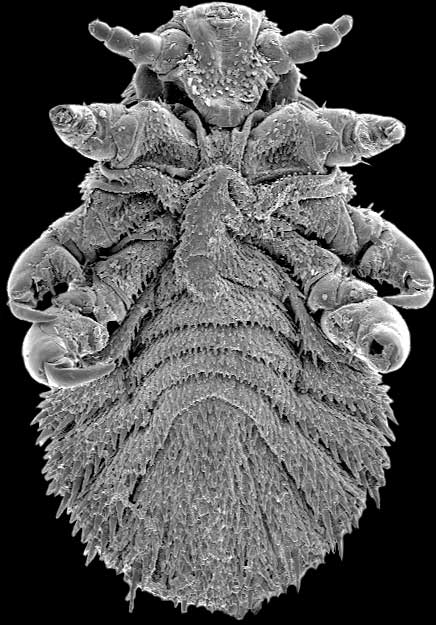 an electron microscope image of a seal louse