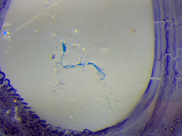 a microscopic image of a denim microfiber