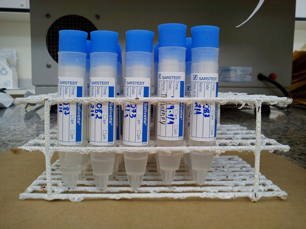 a photo of saliva samples
