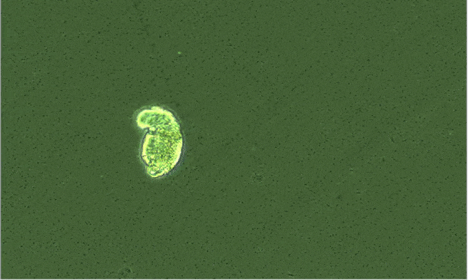 a rotifer stretches and attaches to the bottom of a slide, trying to get out of the field of vision