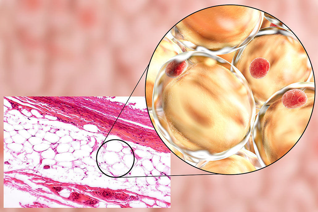 an photo of fat cells under a microscope, with a zoomed in section showing a computer generated image of individual fat cells