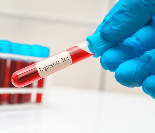 a gloved hand holds a small capped test tube labeled "Triglyceride Test"