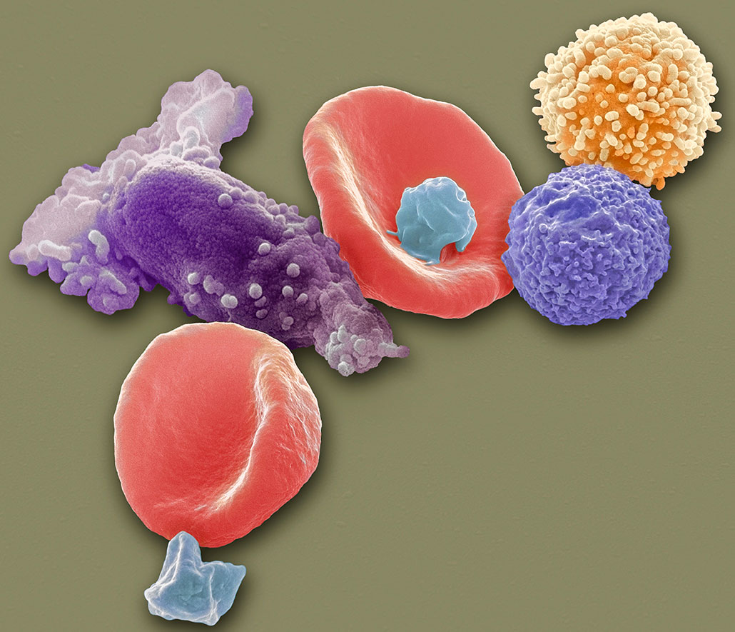a false colored photo showing red blood cells along with platelets and other immune system cells