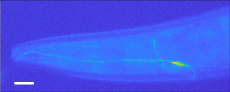 an image showing a glowing neuron in a C. elegans worm